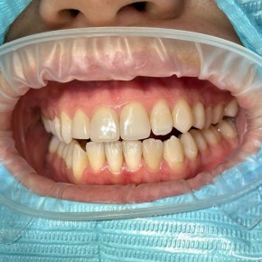 ������ ���������� ������� ������� ��� ����� ��� ������ ��������